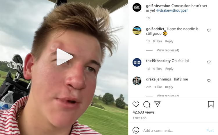 Unlucky golfer gets massive bump on the head after being hit by a golf ball  - SOCAL Golfer